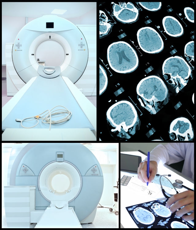 CT-cko
